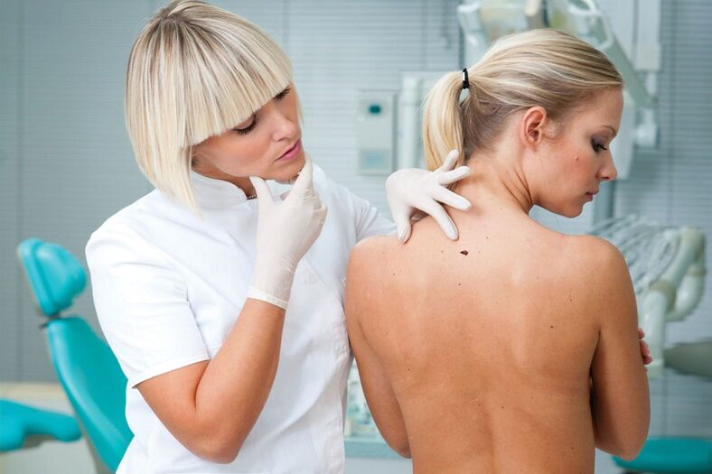 porque papilomas aparecem no corpo humano