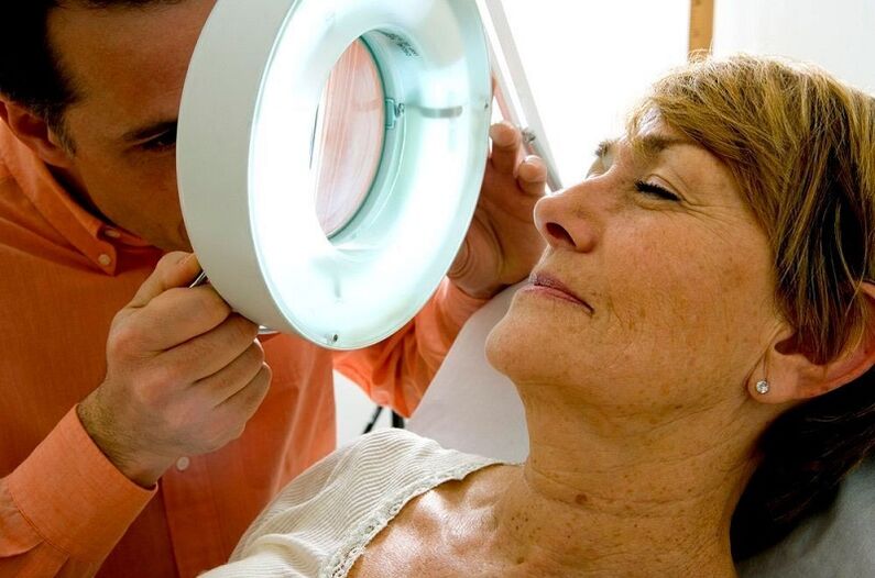 procedimento de exame de papiloma facial